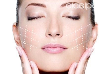 TRATAMIENTO HIFU PARA EL ROSTRO | Clasipar Belleza / Estética - TRATAMIENTO HIFU PARA EL ROSTRO