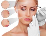 TRATAMIENTO PLASMA RICO EN PLAQUETA, HILO EN PDO, HIFU | Clasipar Belleza / Estética - TRATAMIENTO PLASMA RICO EN PLAQUETA, HILO EN PDO, HIFU