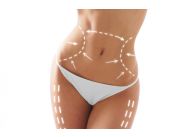 TRATAMIENTO REDUCTOR EFECTO VELASHAPE CON 60 SESIONES COMBINADAS | Clasipar Belleza / Estética - TRATAMIENTO REDUCTOR EFECTO VELASHAPE CON 60 SESIONES COMBINADAS