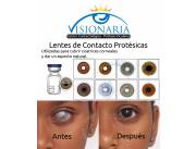 Lentes de Contacto Protésicas color Marrón A5 Lentes de Contacto Protésicas color Marrón A5