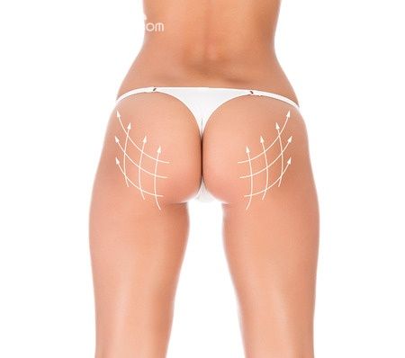 TRATAMIENTO GLÚTEOS PERFECTOS | Clasipar Belleza / Estética - TRATAMIENTO GLÚTEOS PERFECTOS