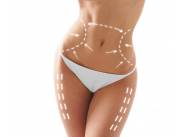 MESOTERAPIA MESOTERAPIA
