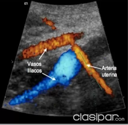 Para que sirve la ecografia doppler fetal
